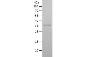 Western Blotting (WB) image for Neuroglobin (NGB) (AA 1-151) protein (His-IF2DI Tag) (ABIN7124150) (Neuroglobin Protein (NGB) (AA 1-151) (His-IF2DI Tag))