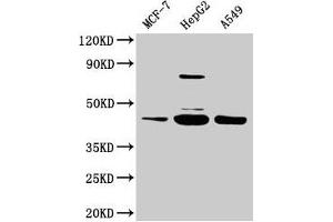 Western Blot Positive WB detected in: MCF-7 whole cell lysate, HepG2 whole cell lysate, A549 whole cell lysate All lanes: SERPINB1 antibody at 2 μg/mL Secondary Goat polyclonal to rabbit IgG at 1/50000 dilution Predicted band size: 43, 27 kDa Observed band size: 43 kDa (SERPINB1 antibody  (AA 1-379))