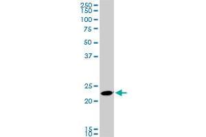 Western Blotting (WB) image for anti-RAB11A, Member RAS Oncogene Family (RAB11A) (AA 1-216) antibody (ABIN563774)