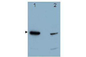 Image no. 1 for anti-Programmed Cell Death 4 (PDCD4) (C-Term) antibody (ABIN318336) (PDCD4 antibody  (C-Term))