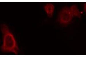 ABIN6272310 staining RAW264. (GPRC5C antibody)