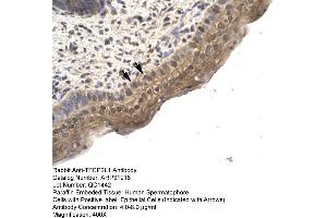 Human Spermatophore (TFCP2L1 antibody  (N-Term))