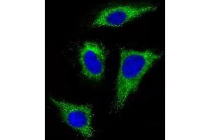 Immunofluorescent analysis of 4 % paraformaldehyde-fixed, 0. (FGFR1 antibody  (C-Term))