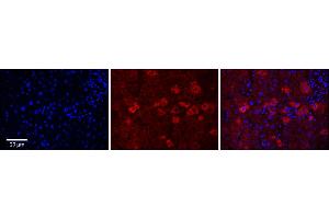 Rabbit Anti-CYP4F3 Antibody      Formalin Fixed Paraffin Embedded Tissue: Human Adult Liver   Observed Staining: Cytoplasm in hepatocytes, strong signal, moderate tissue distribution  Primary Antibody Concentration: 1:100  Secondary Antibody: Donkey anti-Rabbit-Cy3  Secondary Antibody Concentration: 1:200  Magnification: 20X  Exposure Time: 0. (CYP4F3 antibody  (N-Term))