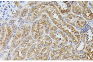 Immunohistochemistry of paraffin-embedded Mouse kidney using PPP2R5D Polyclonal Antibody at dilution of 1:100 (40x lens).