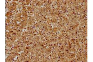IHC image of ABIN7171626 diluted at 1:400 and staining in paraffin-embedded human adrenal gland tissue performed on a Leica BondTM system. (TBC1D25 antibody  (AA 1-219))