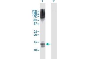 Western Blot analysis of NFATC2IP expression in transfected 293T cell line by NFATC2IP MaxPab polyclonal antibody. (NFATC2IP antibody  (AA 1-138))