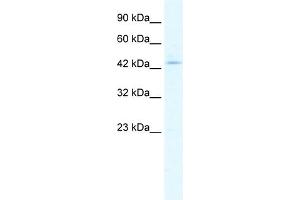 WB Suggested Anti-CLIC5 Antibody Titration:  1. (CLIC5 antibody  (Middle Region))