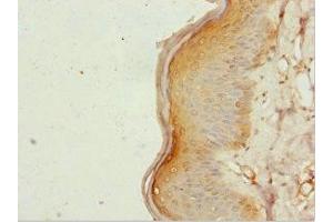 Immunohistochemistry of paraffin-embedded human skin tissue using ABIN7161952 at dilution of 1:100 (ZC3HC1 antibody  (AA 1-260))