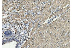 IHC analysis of TP53I13 using anti-TP53I13 antibody (ABIN7601220). (TP53I13 antibody  (AA 30-365))
