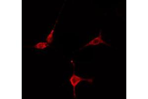 ABIN6274754 staining COLO205 cells by IF/ICC. (RPS27L antibody  (N-Term))