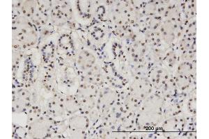 Immunoperoxidase of monoclonal antibody to CBFA2T2 on formalin-fixed paraffin-embedded human salivary gland. (CBFA2T2 antibody  (AA 201-304))