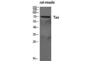 Western Blotting (WB) image for anti-tau Protein (Ser83) antibody (ABIN3180355) (tau antibody  (Ser83))