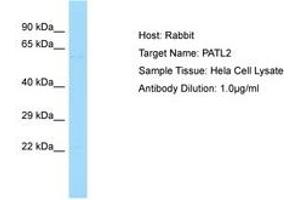 Image no. 1 for anti-Protein Associated with Topoisomerase II Homolog 2 (PATL2) (AA 313-362) antibody (ABIN6750126) (PATL2 antibody  (AA 313-362))