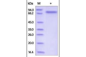 Human Semaphorin 4A, His Tag on SDS-PAGE under reducing (R) condition. (Sema4a Protein (AA 33-683) (His tag))