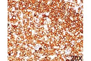 IHC testing of human tonsil (20X) stained with CD79a antibody (JCB117). (CD79a antibody  (AA 202-216))