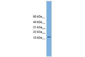MAGEA5 antibody used at 1 ug/ml to detect target protein. (MAGEA5 antibody  (N-Term))