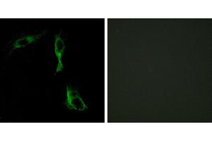 Peptide - +Immunohistochemistry analysis of paraffin-embedded human breast carcinoma tissue using ADRA1D antibody.