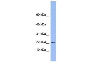 RPS24 antibody used at 1 ug/ml to detect target protein. (RPS24 antibody  (Middle Region))
