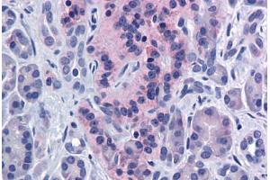 Human Pancreas: Formalin-Fixed, Paraffin-Embedded (FFPE) (SIRT4 antibody  (AA 216-265))