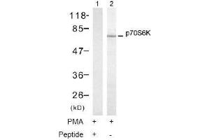Image no. 1 for anti-Ribosomal Protein S6 Kinase, 70kDa, Polypeptide 1 (RPS6KB1) (Thr421) antibody (ABIN197499) (RPS6KB1 antibody  (Thr421))