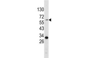 Western Blotting (WB) image for anti-Tyrosinase (TYR) (AA 486-513) antibody (ABIN3029406)