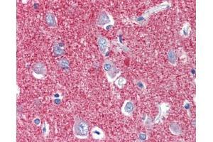 Immunohistochemistry (IHC) image for anti-Solute Carrier Family 25, Member 28 (SLC25A28) (C-Term) antibody (ABIN2781696) (SLC25A28 antibody  (C-Term))