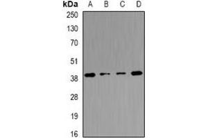 Western blot analysis of Tropomodulin-4 expression in mouse heart (A), mouse skeletal muscle (B), mouse brain (C), rat skeletal muscle (D) whole cell lysates. (Tropomodulin 4 antibody)
