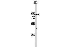 Image no. 1 for anti-K-Cadherin (CDH6) (C-Term) antibody (ABIN356890) (CDH6 antibody  (C-Term))