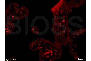 Formalin-fixed and paraffin embedded human placenta tissue labeled with Rabbit Anti-GM-CSF Polyclonal Antibody (ABIN730723), Unconjugated 1:200 followed by conjugation to the secondary antibody and DAB staining (GM-CSF antibody  (AA 71-141))