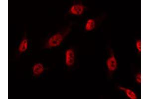ABIN6274536 staining NIH-3T3 by IF/ICC. (DBF4 antibody  (Internal Region))