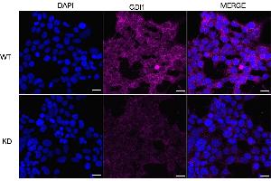 anti-GDP Dissociation Inhibitor 1 (GDI1) antibody
