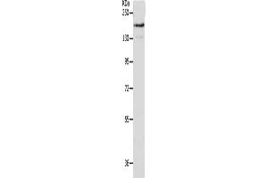 Gel: 10 % SDS-PAGE, Lysate: 40 μg, Lane: A549 cells, Primary antibody: ABIN7191635(NFASC Antibody) at dilution 1/400, Secondary antibody: Goat anti rabbit IgG at 1/8000 dilution, Exposure time: 1 minute (NFASC antibody)