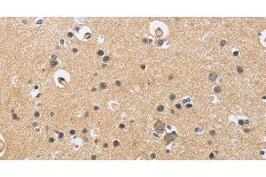 Immunohistochemistry of paraffin-embedded Human brain using CKMT2 Polyclonal Antibody at dilution of 1:60 (CKMT2 antibody)