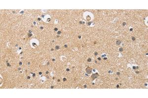Immunohistochemistry of paraffin-embedded Human brain using CKMT2 Polyclonal Antibody at dilution of 1:60
