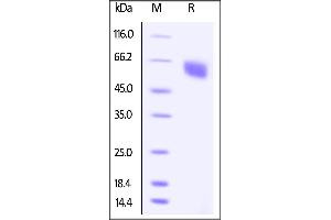 SDS-PAGE (SDS) image for B and T Lymphocyte Associated (BTLA) (AA 31-134) (Active) protein (Fc Tag,AVI tag,Biotin) (ABIN4949010)