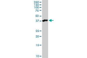 ASPN MaxPab rabbit polyclonal antibody. (Asporin antibody  (AA 1-384))