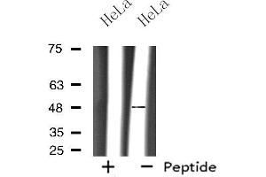 Western blot analysis of extracts from HeLa cells, using OPRM1 antibody. (Mu Opioid Receptor 1 antibody  (C-Term))