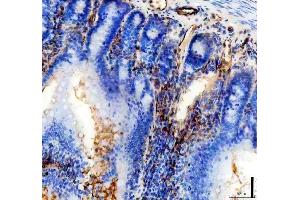 IHC analysis of CD31/Pecam1 using anti-CD31/Pecam1 antibody (ABIN7601662).