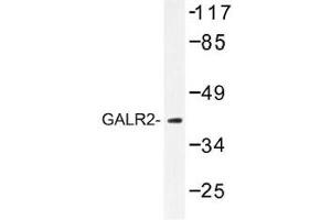 Image no. 1 for anti-Galanin Receptor 2 (GALR2) antibody (ABIN317752) (GALR2 antibody)