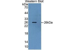 Western Blotting (WB) image for anti-Suppressor of Cytokine Signaling 3 (SOCS3) antibody (Biotin) (ABIN1174917) (SOCS3 antibody  (Biotin))