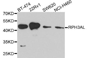 Western blot analysis of extracts of various cell lines, using RPH3AL antibody. (RPH3AL antibody)