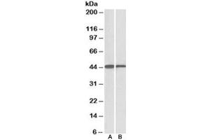 Western blot testing of mouse [A] and rat [B] liver lysate with ACAT1 antibody at 0. (ACAT1 antibody)