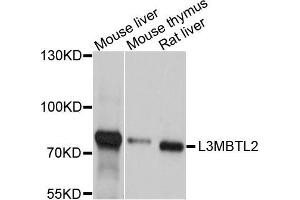 Western blot analysis of extract of various cells, using L3MBTL2 antibody. (L3MBTL2 antibody)