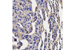 Immunohistochemistry of paraffin-embedded mouse lung cancer using KLRD1 antibody at dilution of 1:200 (x400 lens) (CD94 antibody)