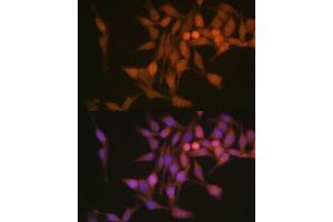 Immunofluorescence analysis of HeLa cells using PSMB6 Polyclonal Antibody (ABIN1682336, ABIN3018469, ABIN3018470 and ABIN6220475) at dilution of 1:100 (40x lens). (PSMB6 antibody  (AA 35-239))