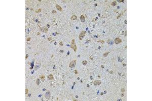 Immunohistochemistry of paraffin-embedded mouse brain using EIF4A2 antibody. (EIF4A2 antibody  (AA 1-270))