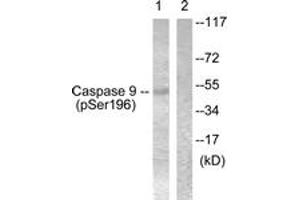 Western blot analysis of extracts from 293 cells treated with Calyculin 50nM 30', using Caspase 9 (Phospho-Ser196) Antibody. (Caspase 9 antibody  (pSer196))