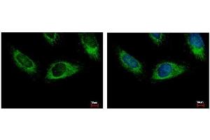 ICC/IF Image HPS3 antibody [C3], C-term detects HPS3 protein at cytoplasm by immunofluorescent analysis. (HPS3 antibody  (C-Term))