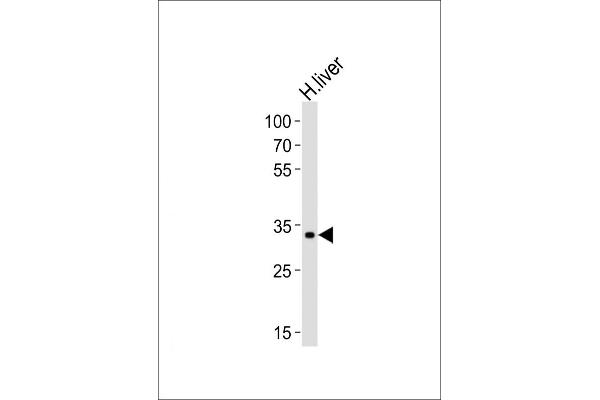 Leucine Rich Transmembrane and 0-Methyltransferase Domain Containing (LRTOMT) (AA 2-36), (N-Term) antibody